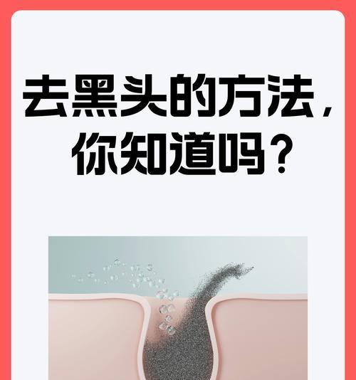 开黑时遇到的常见问题有哪些？